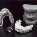 tonuge retaining devices at Progressive Dental