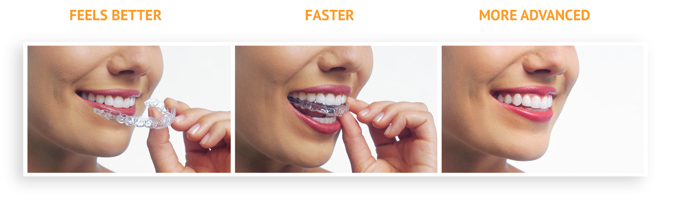 Invisalign  Route 9 Dental