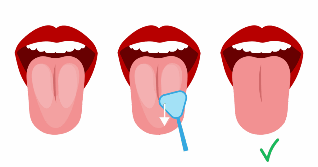 diagram showing how to use a tongue scraper